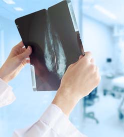 Breast calcifications – their definitions and types